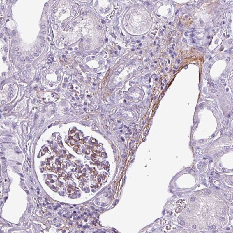 Anti-ATP10A Antibody