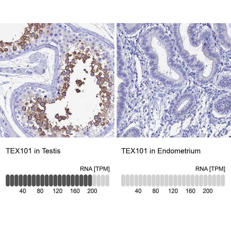 Anti-TEX101 Antibody