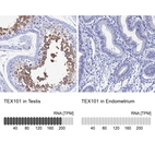 Anti-TEX101 Antibody