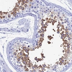 Immunohistochemical staining of human testis shows high expression.