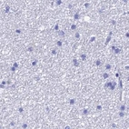 Immunohistochemical staining of human cerebral cortex using Anti-TEX101 antibody HPA042513.