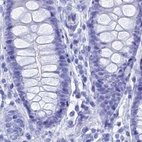 Immunohistochemical staining of human colon using Anti-TEX101 antibody HPA042513.