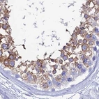 Immunohistochemical staining of human testis using Anti-TEX101 antibody HPA042513.