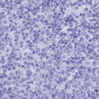 Immunohistochemical staining of human tonsil using Anti-TEX101 antibody HPA042513.