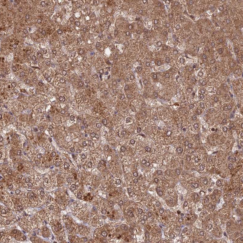 Anti-C2orf91 Antibody