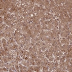 Anti-C2orf91 Antibody