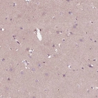 Immunohistochemical staining of human cerebral cortex shows no positivity in neurons as expected.