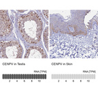 Anti-CENPV Antibody