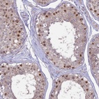 Anti-CENPV Antibody