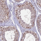 Immunohistochemical staining of human testis shows high expression.
