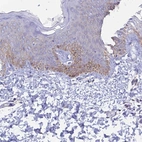 Immunohistochemical staining of human skin shows low expression as expected.