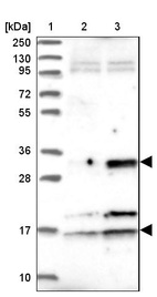 Lane 1: Marker [kDa] 250, 130, 95, 72, 55, 36, 28, 17, 10_br/_Lane 2: Human cell line RT-4_br/_Lane 3: Human cell line U-251MG sp