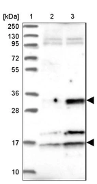 Lane 1: Marker [kDa] 250, 130, 95, 72, 55, 36, 28, 17, 10_br/_Lane 2: Human cell line RT-4_br/_Lane 3: Human cell line U-251MG sp