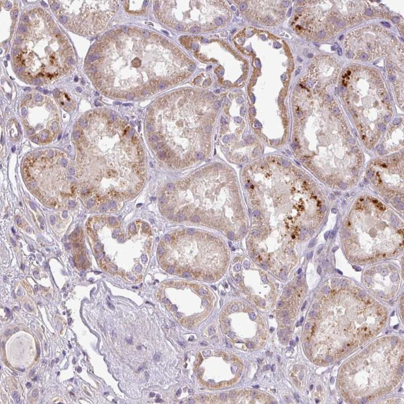 Anti-ZDHHC1 Antibody