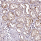 Anti-ZDHHC1 Antibody