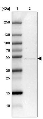 Lane 1: Marker [kDa] 250, 130, 100, 70, 55, 35, 25, 15, 10_br/_Lane 2: Human Tonsil tissue