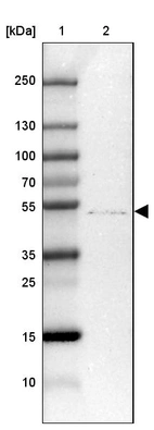 Lane 1: Marker [kDa] 250, 130, 100, 70, 55, 35, 25, 15, 10_br/_Lane 2: Human Tonsil tissue