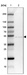 Anti-ZDHHC1 Antibody