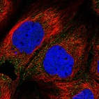 Immunofluorescent staining of human cell line A-431 shows localization to cytosol.