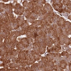 Anti-COG4 Antibody