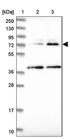 Lane 1: Marker [kDa] 250, 130, 95, 72, 55, 36, 28, 17, 10_br/_Lane 2: Human cell line RT-4_br/_Lane 3: Human cell line U-251MG sp