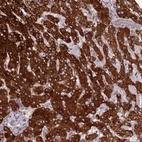 Anti-EEF1AKMT1 Antibody