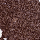 Anti-CACTIN Antibody