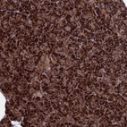 Anti-CACTIN Antibody