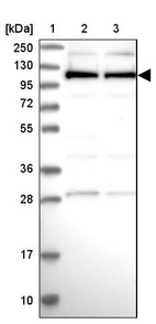 Lane 1: Marker [kDa] 250, 130, 95, 72, 55, 36, 28, 17, 10_br/_Lane 2: Human cell line RT-4_br/_Lane 3: Human cell line U-251MG sp