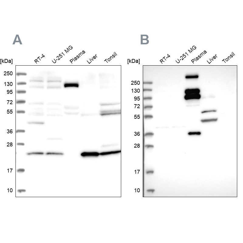 Anti-REXO1 Antibody
