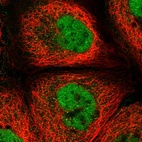 Immunofluorescent staining of human cell line A-431 shows localization to nucleoplasm.