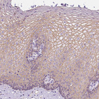 Immunohistochemical staining of human esophagus shows moderate membranous positivity in squamous epithelial cells.