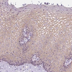 Immunohistochemical staining of human esophagus shows moderate membranous positivity in squamous epithelial cells.