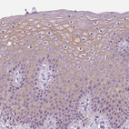 Immunohistochemical staining of human skin shows weak to moderate membranous positivity in squamous epithelial cells.