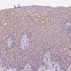 Immunohistochemical staining of human skin shows weak to moderate membranous positivity in squamous epithelial cells.