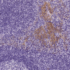 Immunohistochemical staining of human tonsil shows moderate membranous positivity in squamous epithelial cells.