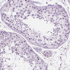 Immunohistochemical staining of human testis shows no positivity in cells in seminiferous ducts as expected.