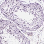Immunohistochemical staining of human testis shows no positivity in cells in seminiferous ducts as expected.
