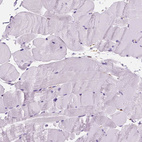 Immunohistochemical staining of human skeletal muscle shows no positivity in myocytes as expected.