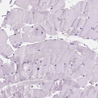 Immunohistochemical staining of human skeletal muscle shows no positivity in myocytes as expected.