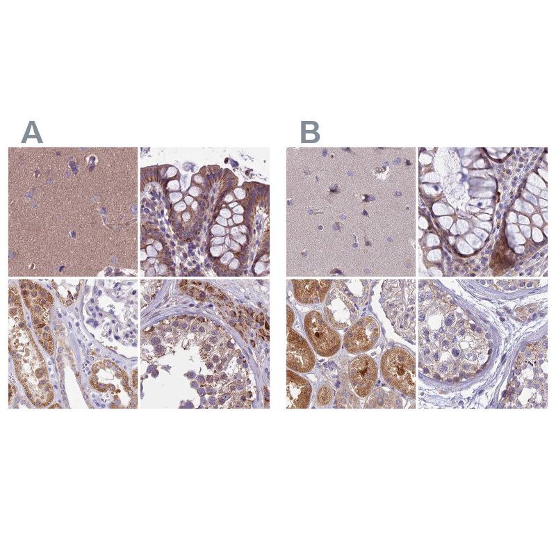 Anti-DUS2 Antibody