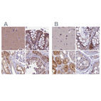Anti-DUS2 Antibody