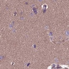 Immunohistochemical staining of human cerebral cortex using Anti-DUS2 antibody HPA042560.