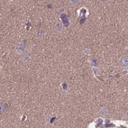 Immunohistochemical staining of human cerebral cortex using Anti-DUS2 antibody HPA042560.