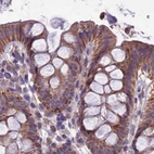 Immunohistochemical staining of human colon using Anti-DUS2 antibody HPA042560.