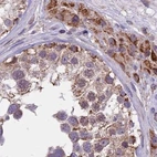 Immunohistochemical staining of human testis using Anti-DUS2 antibody HPA042560.