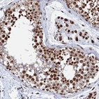 Immunohistochemical staining of human Testis shows strong nuclear positivity in cells in seminiferous ducts.