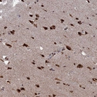 Immunohistochemical staining of human Cerebral cortex shows strong nuclear positivity in neuronal and glial cells.