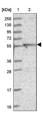 Lane 1: Marker [kDa] 250, 130, 95, 72, 55, 36, 28, 17, 10_br/_Lane 2: Human cell line RT-4