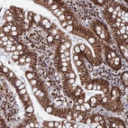 Immunohistochemical staining of human Small intestine shows strong nuclear positivity in glandular cells.